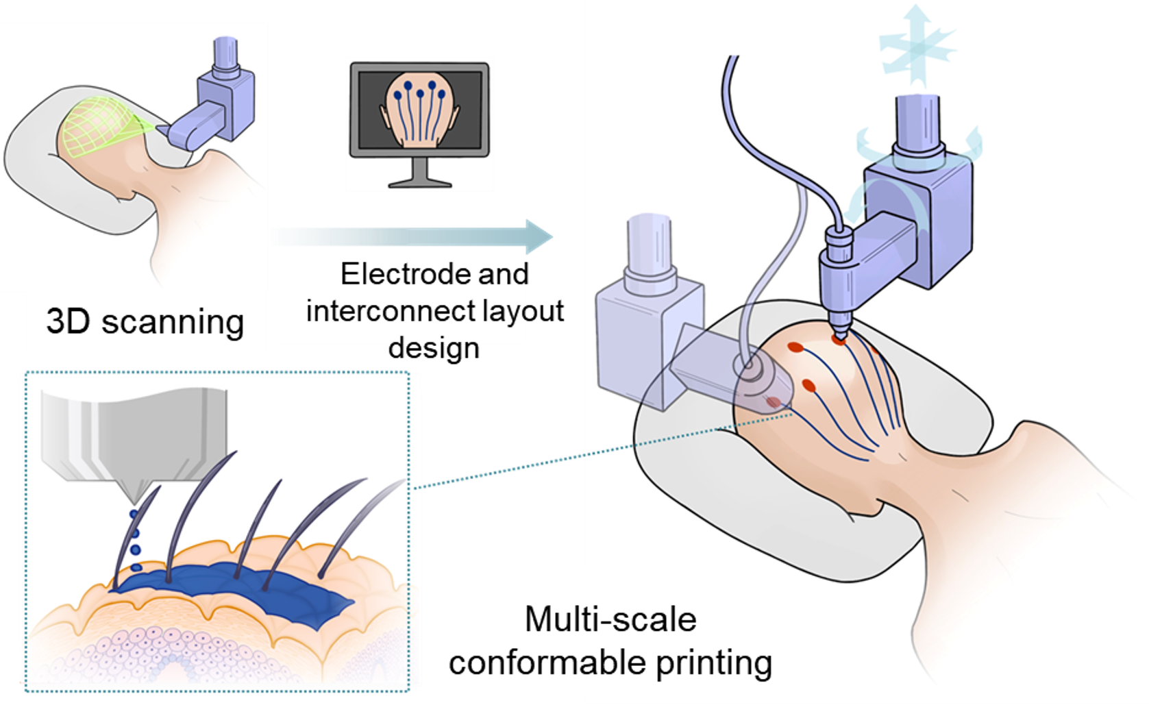 On-Body 3D Printing EEG Tattoo